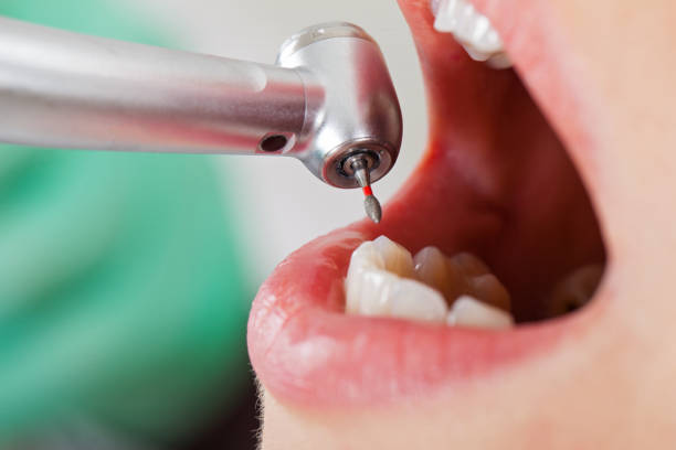 Best Broken or Chipped Tooth Repair in Ardmore, AL